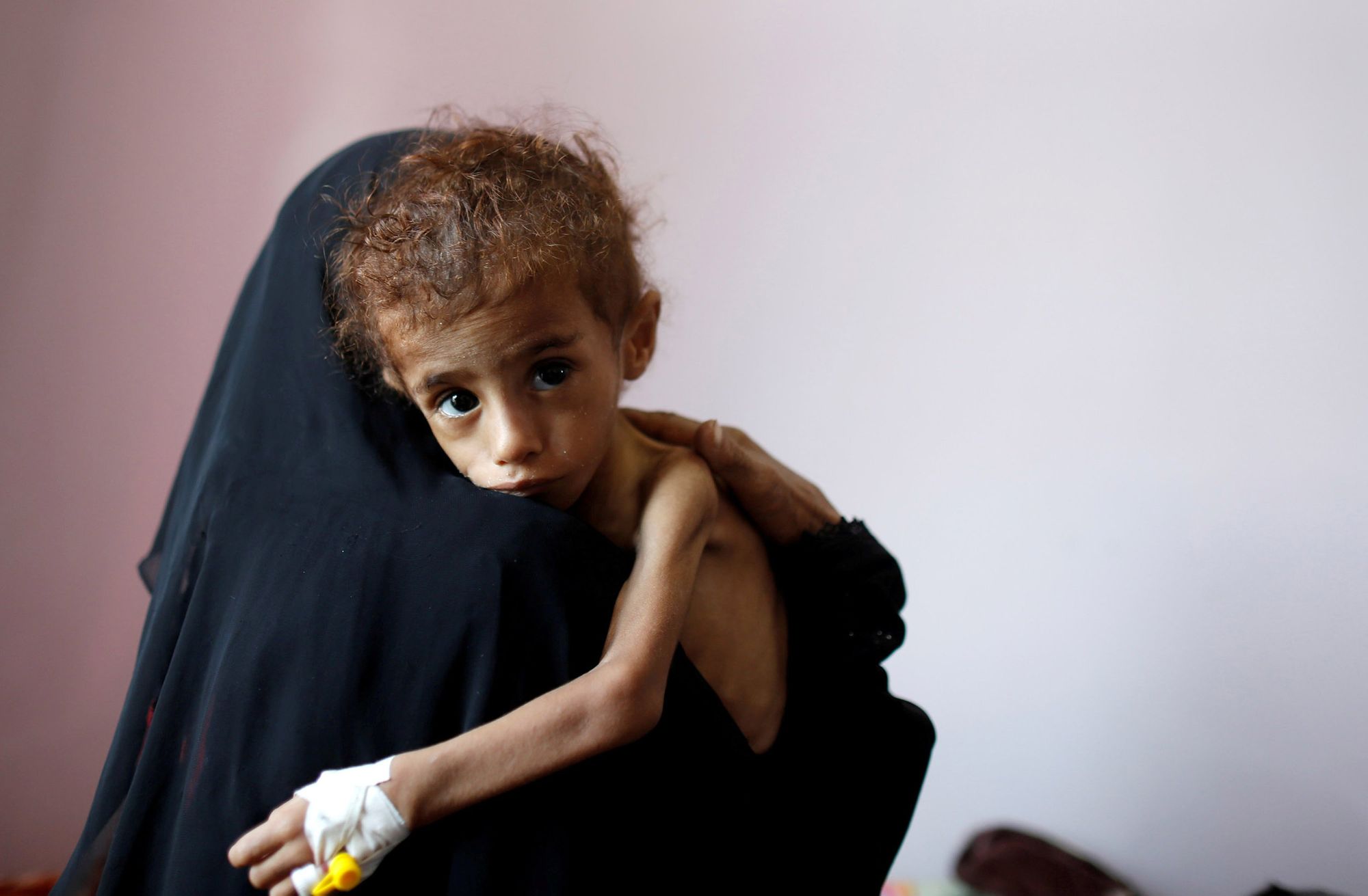 The Yemen Crisis - Worst in the World